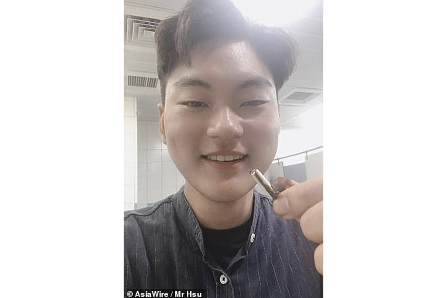 taiwan-man-ben-accidentally-swallowed-apple-airpod-still-working