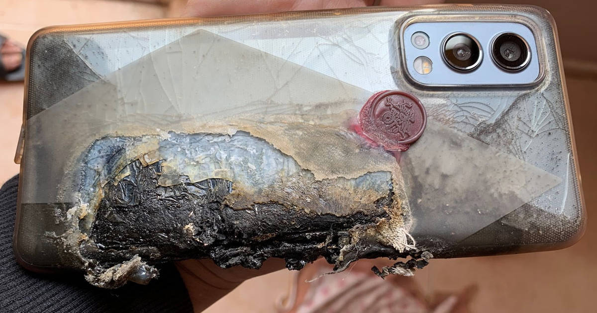 OnePlus Nord 2 Caught Fire In jeans pocket Blast in India user badly burn injured