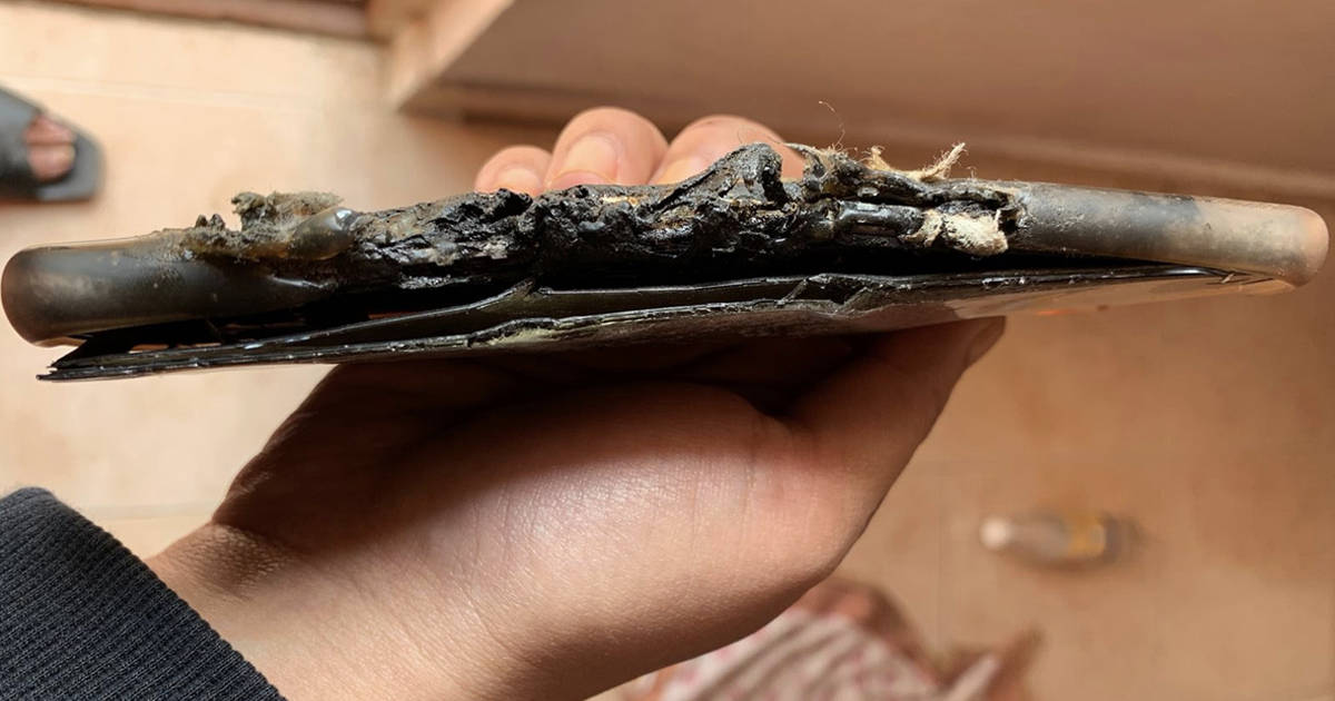 OnePlus Nord 2 Caught Fire In jeans pocket Blast in India user badly burn injured