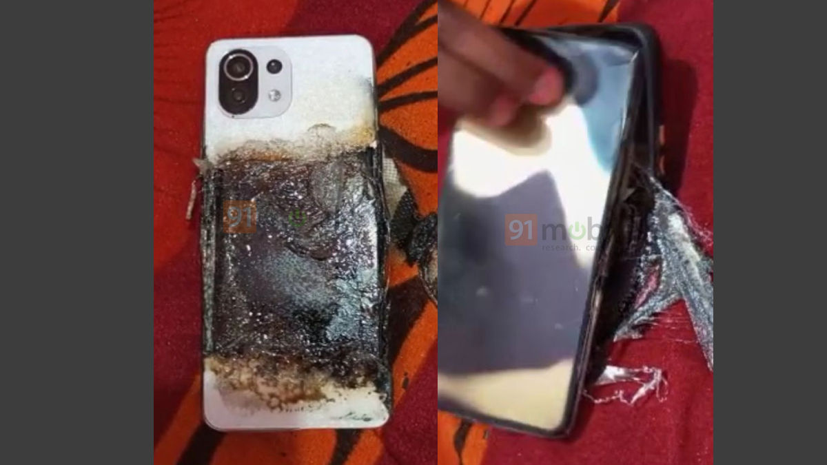 Xiaomi 11 Lite NE blasted, this phone burnt to ashes
